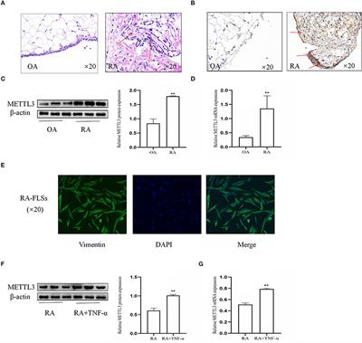 METTL3 Promotes Activation and Inflammation of FLSs Through the NF-κB Signaling Pathway in Rheumatoid Arthritis